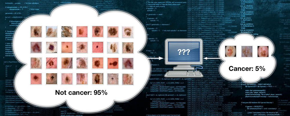 Unbalanced classes in cancer detection